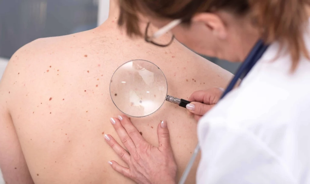 Skin-Cancer in Owensboro, KY | Owensboro Dermatology