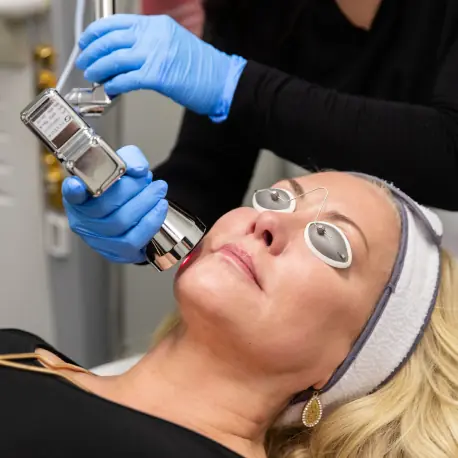 Nano-Peel-Service-Skin-Cancer-And-Laser-Surgery-Center Newburgh, IN| Owensboro Dermatology