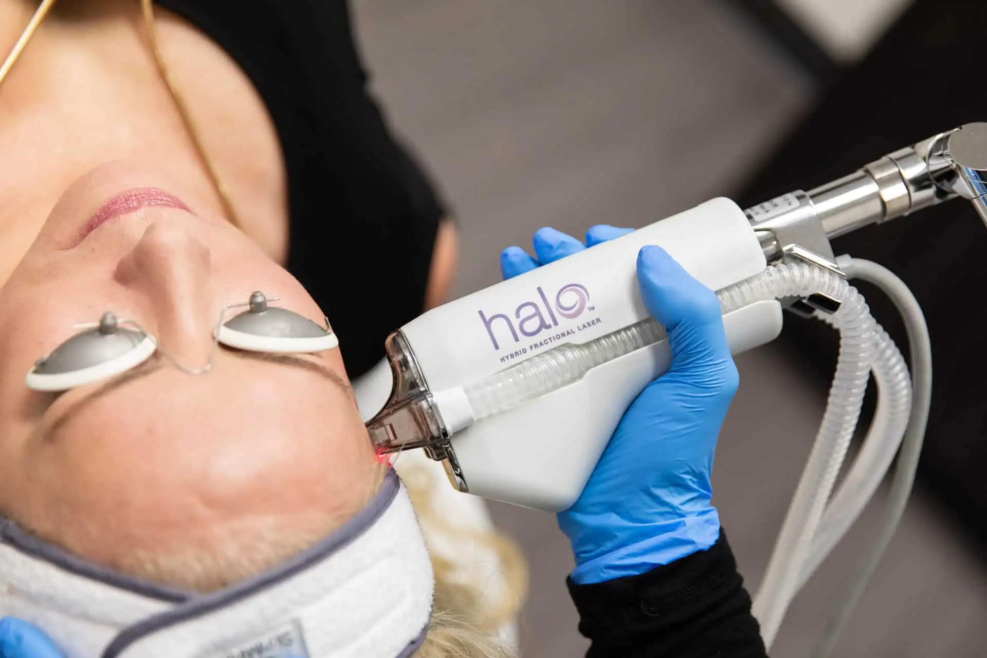 Sciton-HALO-Service-Skin-Cancer-And-Laser-Surgery-Center Newburgh,IN| Owensboro Dermatology