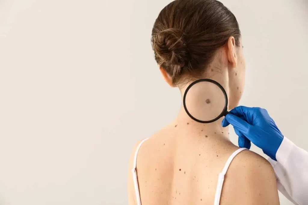 Skin Cancer-Owensboro Dermatology Associates PSC-2821 New Hartford Rd-Owensboro- KY 42303 in Owensboro, KY | Owensboro Dermatology