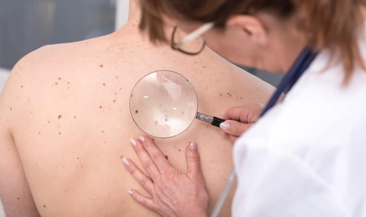 Young female getting skin cancer tretment in Owensboro, KY | Owensboro Dermatology